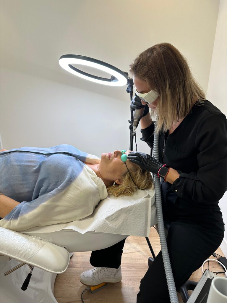 Eliminación con láser de micropigmentación en Alicante - Sandra Olcina Pérez