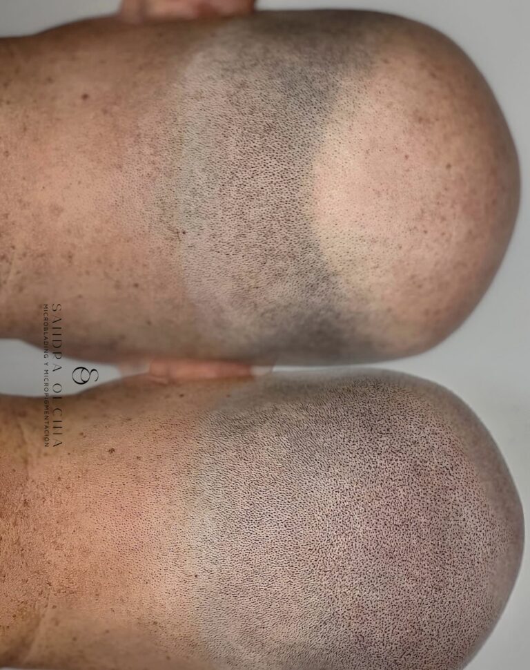 Microblading y Micropigmentación en Alicante - Sandra Olcina Pérez