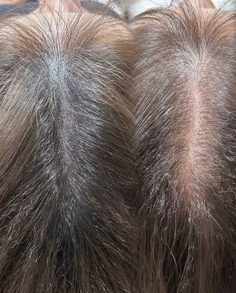 Microblading y Micropigmentación en Alicante - Sandra Olcina Pérez